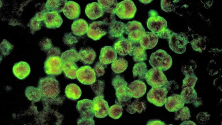 Brain-eating amoeba detected in Louisiana water system