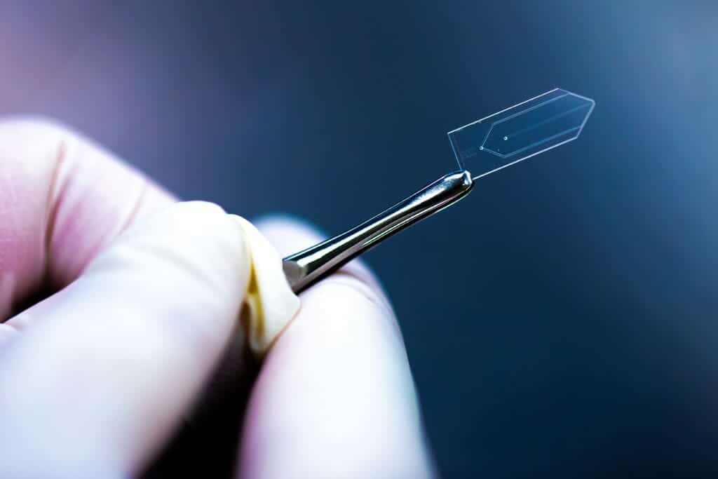 photo: a small glass chip held in a forceps